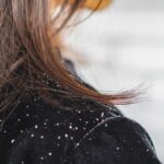 Dandruff Causes and Prevention